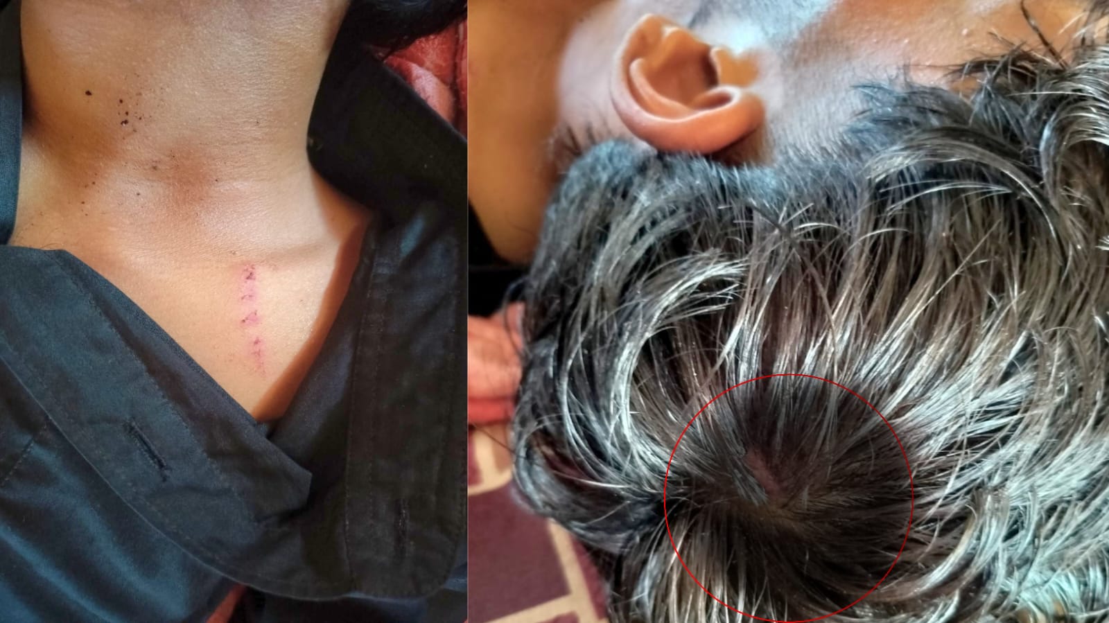 सर्लाहीमा दिनदहाडै हतियारधारी समूहको आक्रमण, सुनको सिक्री र मोबाइल लुटियो